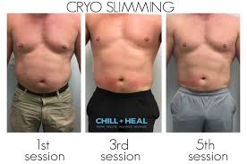They both use cold temperatures but cryo t shock also uses warmer temperatures mixed in to enhance the shock to the cell. Cryo T Shock Treatments Tewksbury Ma Cryobod