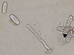 Image result for Uncinula necator