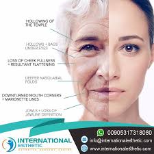 Hair Transplant Hairstyles Surgery Cosmetic Perkutan Percutan تركيا اسطنبول Beauty Hair Eyebrows Nasolabial Folds Esthetics Jawline