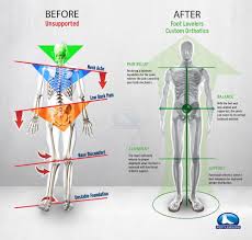 Foundational anatomy provides medical students with the necessary background in anatomy for success in clerkships. Lower Back Pain