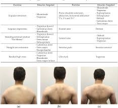 Pdf Thoracic Outlet Syndrome Biomechanical And Exercise Considerations Semantic Scholar