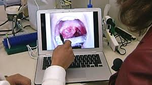 Throat that does not go awaypain or difficulty with chewing or swallowingswelling of the jawhoarseness or other change in the voicepain in the it felt like it was on the floor of my mouth between my side teeth and my gum on the left. Dramatic Increase In Hpv Related Mouth Throat Cancers Among Canadian Men Report Ctv News