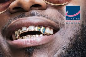 Depending on a lot of factors, you might get a somewhat lower or a significantly higher quote from your dentist. Dental Grillz Gold Silver Grillz Amazing Smiles Dentist Clinics