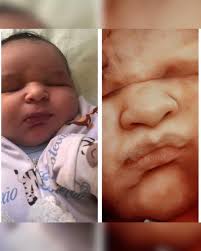 Antes e depois… de um mesmo amor. 💛 A gente sabe que é o mesmo bebê, mas é  impossível não se emocionar ao ver como aquele rostinho que conhecemos  ainda dentro da