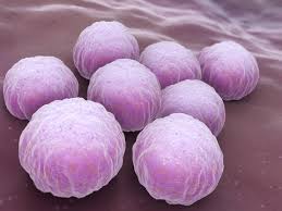 Image result for Chlamydia Trachomatis