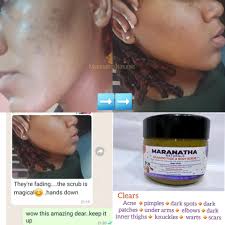 For sale HAIR ₱3,000 Takore Storage Oxidant Bleach powder Spray Alcohol  Alovera Alover mask Bremode Pagoda Conditioner Hairspa Curl lotion Bremode  serum FOOT SPA ₱2,000 Foot mask Foot lotion Massage oil Foot