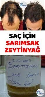 Bu Bitkisel Kur Ile Daha Parlak Ve Guclu Saclara Sahip Olabilirsiniz Sarimsagin Da Zeytinyaginin Da Saca Faydalari Saymakla Bit Sac Saglikli Sac Sac Maskeleri