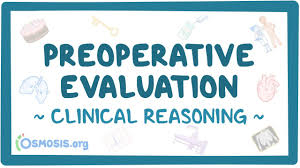 Image result for Preoperative Examination