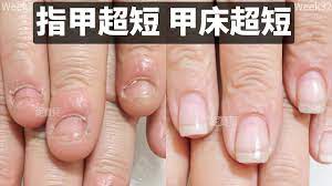 指甲短甲床短 基隆指甲矯正案例 工作嚴重破壞的手指 水晶指甲處理甲床外露 凝膠指甲調整甲型 nails nail polish polish
