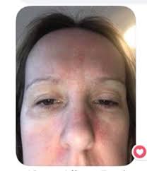 6 weeks old and fully organic, no staple drugs.