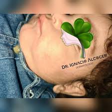 DR.ALCOCERDERMA (@dr.ignacioalcocerdermatologo) · Instagram photos and  videos