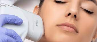 HIFU is the ultimate natural lifting treatment - Skinglow Clinic