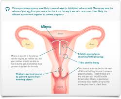 Pin On Birth Control