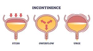 Image result for Functional Incontinence