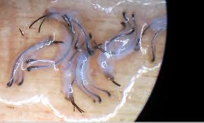 The hair follicle is an organ found in mammalian skin. Men S African American Hair Transplant Dr Sean Behnam
