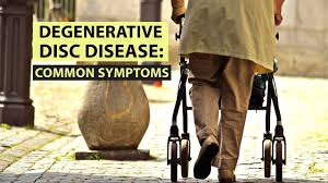 Degenerative Disc Disease Common Symptoms Youtube