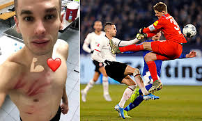 Born 8 february 1995) is a serbian professional footballer who plays as a midfielder for bundesliga club 1899 hoffenheim and the serbia national team. Frankfurt Midfielder Gacinovic On Receiving End Of Karate Kick From Schalke Goalkeeper Nubel Daily Mail Online