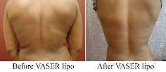 Park, md is a board certified plastic surgeon specializing in cosmetic and reconstructive plastic surgery in the inland empire. Before After Cosmetic Surgery Medical Face Body Aesthetics