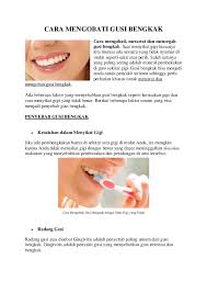 Panduan cara menghilangkan gusi bengkak dengan berbagai macam obat gusi bengkak dari bahan alami tradisional dan obat medis, serta tips mencegahnya. Pdf Cara Mengobati Gusi Bengkak Lisa Louman Academia Edu