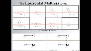 It everts skin well and spreads tension along the wound edge. How To Create A Horizontal Mattress Suture By Surgicalmaster Youtube