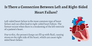 Image result for Right Heart Failure