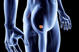 Physical examinations typically find breast cancers when they are much larger than those detected by mammography. Home Urine Test For Prostate Cancer Reveals Its Most Aggressive Forms
