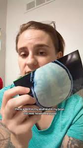 2023 🥳 #brain #braininjurysurvivor #traumaticbraininjury #mri #imaging  #neurolgy #romanian #orphanage #adoption #adopted #adoptee  #adopteesoftiktok #adopteevoices #adopteeproblems #adopteetiktok ...