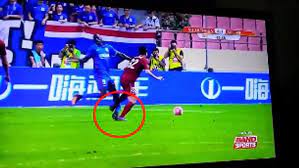 Discover the magic of the internet at imgur, a community powered entertainment destination. Demba Ba Horrific Leg Break Vs Shanghai Sipg F C Video Dailymotion