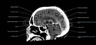 Pin De Karol Em Axiomatic Radiologia