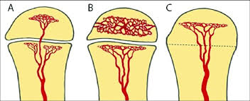 Consider drawing your fish on a flip chart or large dry erase board. Schematic Drawing Of Vascularization Of The Long Bone Modified From Download Scientific Diagram