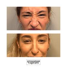 Gallery Of Botox Denver| Greenwood Village