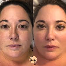 Tiffany Sharp MSN APN CRNA