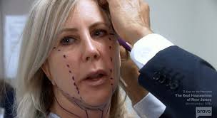 Kelly Dodd Rips Vicki Gunvalson Over Facelift "Malfunction"