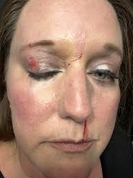 Please pray for Jennifer Whetsel and her family. We love you Jen.