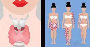 Sintomas Que Debes Tomar En Cuenta Tu Tiroides Es El Organo Que Produce La Hormona Que Regula La Temperatura El Meta Gastritis Symptoms Sign Solutions Stomach