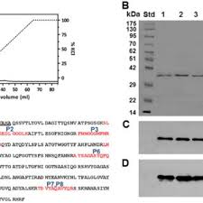 Corporate profile trusted in delivering excellence. Pdf Porin Involvement In Cephalosporin And Carbapenem Resistance Of Burkholderia Pseudomallei