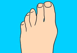 Bill tweak di antara ibu jari dan telunjuk. Intip Nasib Dan Keberuntungan Anda Berdasarkan Bentuk Jari Kaki Sonora Id