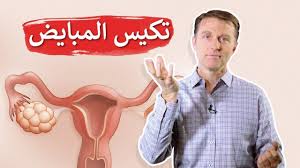 تكيس المبايض الدكتور بيرج يشرح أعراض و المسبب لمتلازمة تكيس المبايض و Ronald Mcdonald Mcdonald Ronald