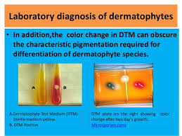 Dermatophytes Undergraduates