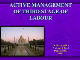Image result for Active Management of Labor