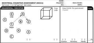 The scoring criteria for the cdt in the moca has been simplified to decrease scoring complexity, scoring time, and minimize inter rater variability. Donald Trump Scored 100 On This Cognitive Ability Test Can You Match The Stable Genius