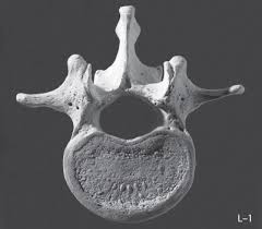 Image result for Lumbar vertebrae