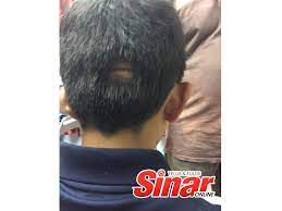 Maybe you would like to learn more about one of these? Kepala Pelajar Pecah Selepas Terkena Bilah Mesin Rumput Terbang Dari Padang Sekolah Remaja