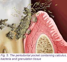 Dentaltown Magazine Odontologia Salud Dental Higienista Dental