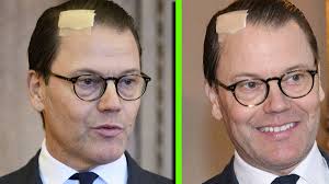 Därför har prins Daniel ett plåster i pannan: "Ingrepp"