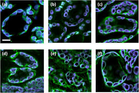Most plants and algae produce a carbohydrate called starch, which provides the plant with a dense store of energy. Pii1 A Protein Involved In Starch Initiation That Determines Granule Number And Size In Arabidopsis Chloroplast Biorxiv