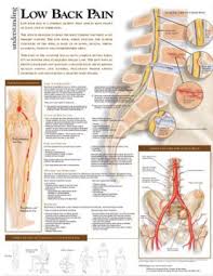 Understanding Low Back Pain Anatomical Chart Other Format