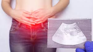 Allerdings kann es sein, dass die hernie operiert werden muss, um entzündungen, funktionsstörungen der organe oder ein weiteres aufreißen der. Verschluss Einer Hernia Umbilicalis Krankenhaus De