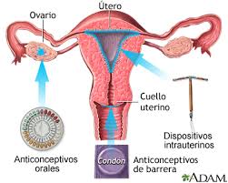 Metodos Anticonceptivos De Liberacion Lenta Medlineplus Enciclopedia Medica