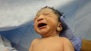 Natural Birth Vs C Section Delivery Method Pros And Cons